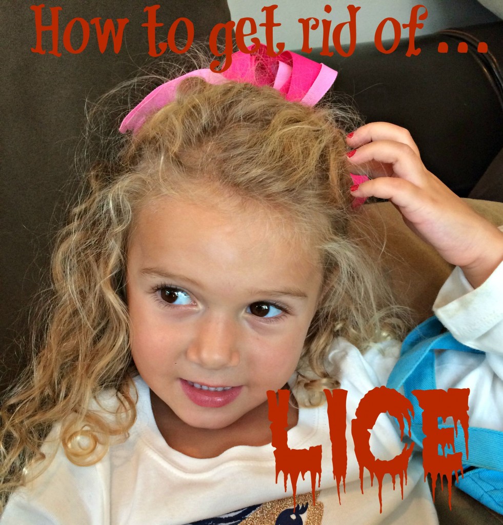 How to get rid of lice!